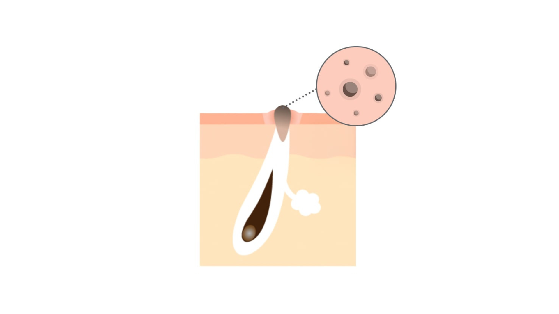 【毛穴の黒ずみの原因って？】絶対にやってはいけないケアと正しいケアを徹底解説！